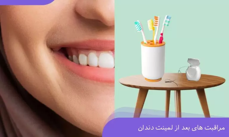 دکتر نگار عطاءاللهی شیراز لمینت دندان