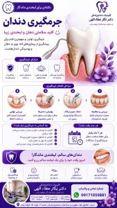 جرمگیری دندان دندانپزشکی دکتر نگار عطاءاللهی