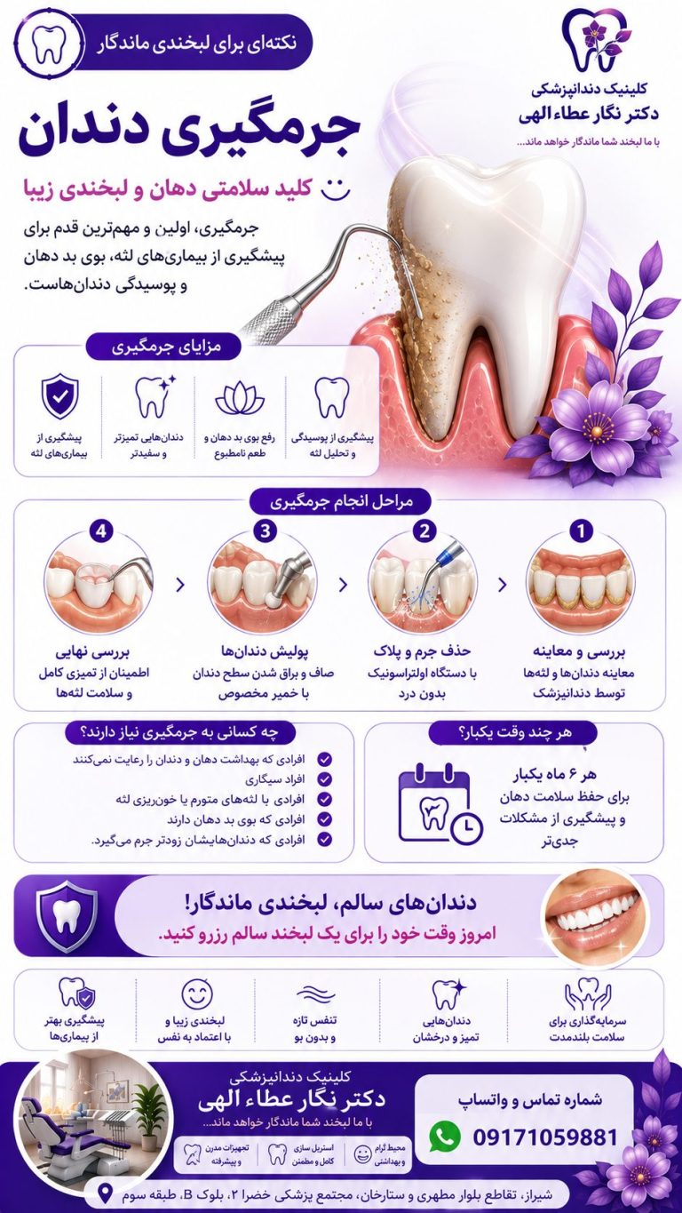 جرمگیری دندان دندانپزشکی دکتر نگار عطاءاللهی