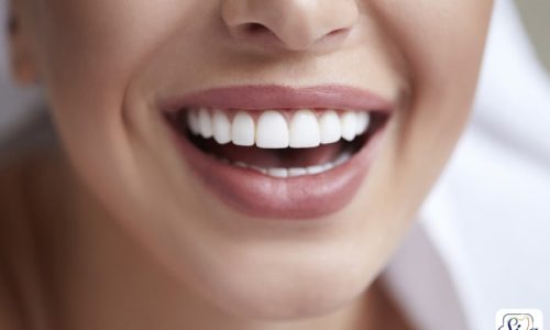 دکتر نگار عطاءاللهی شیراز کامپوزیت دندانپزشکی بیمه کوثر